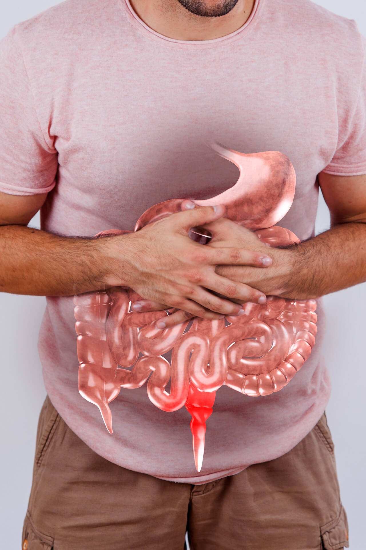 GI-Answers-To-Common-Crohn's-Disease-Questions